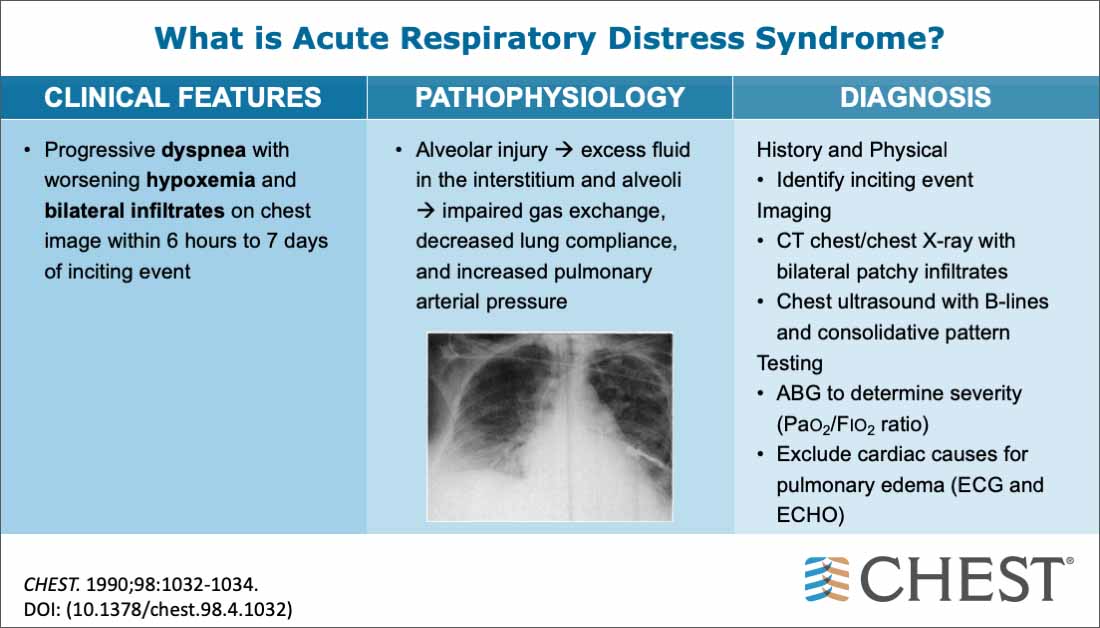 COVID-19: Clinical Resources | COVID-19 - American College Of Chest ...