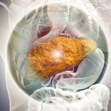 Liver with cirrhosis