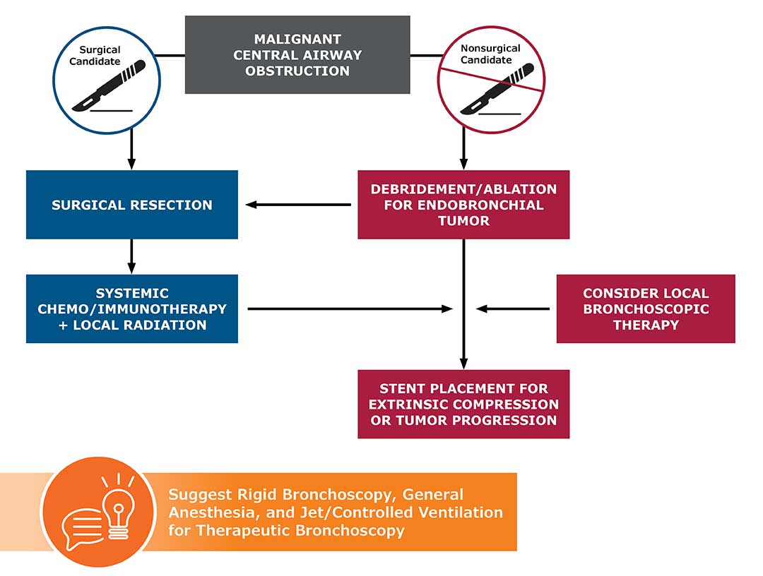 Suggested Approach for the Management of Malignant Central Airway Obstruction