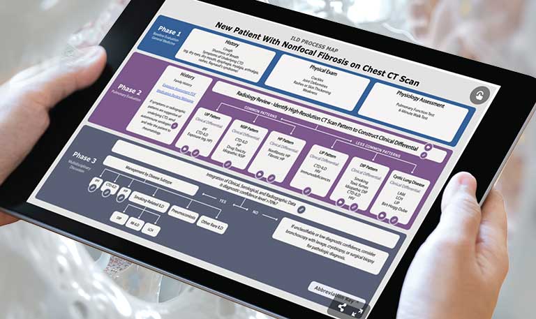 Screenshot of infographic on diagnosis and management of ILD