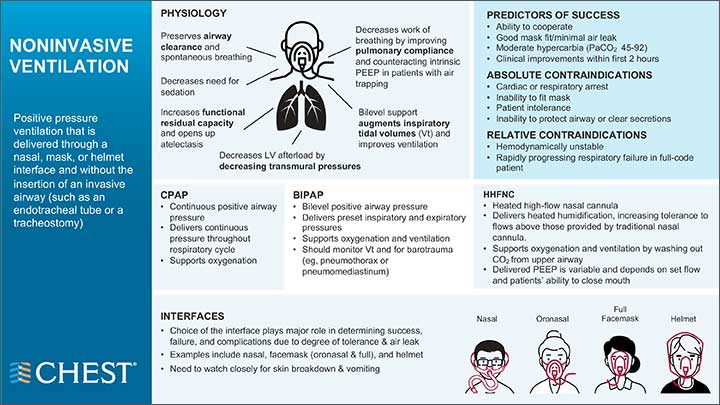 Noninvasive Ventilation infographic