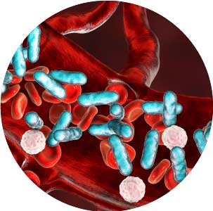 Sepsis, bacteria in blood