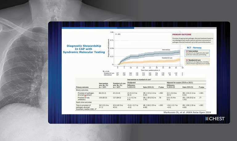 Community-Acquired Pneumonia in Hospitalized Patients - Where Guidelines Meet Clinical Practice webinar image