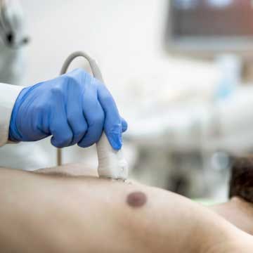 A man laying down has his chest examined with ultrasound technology.