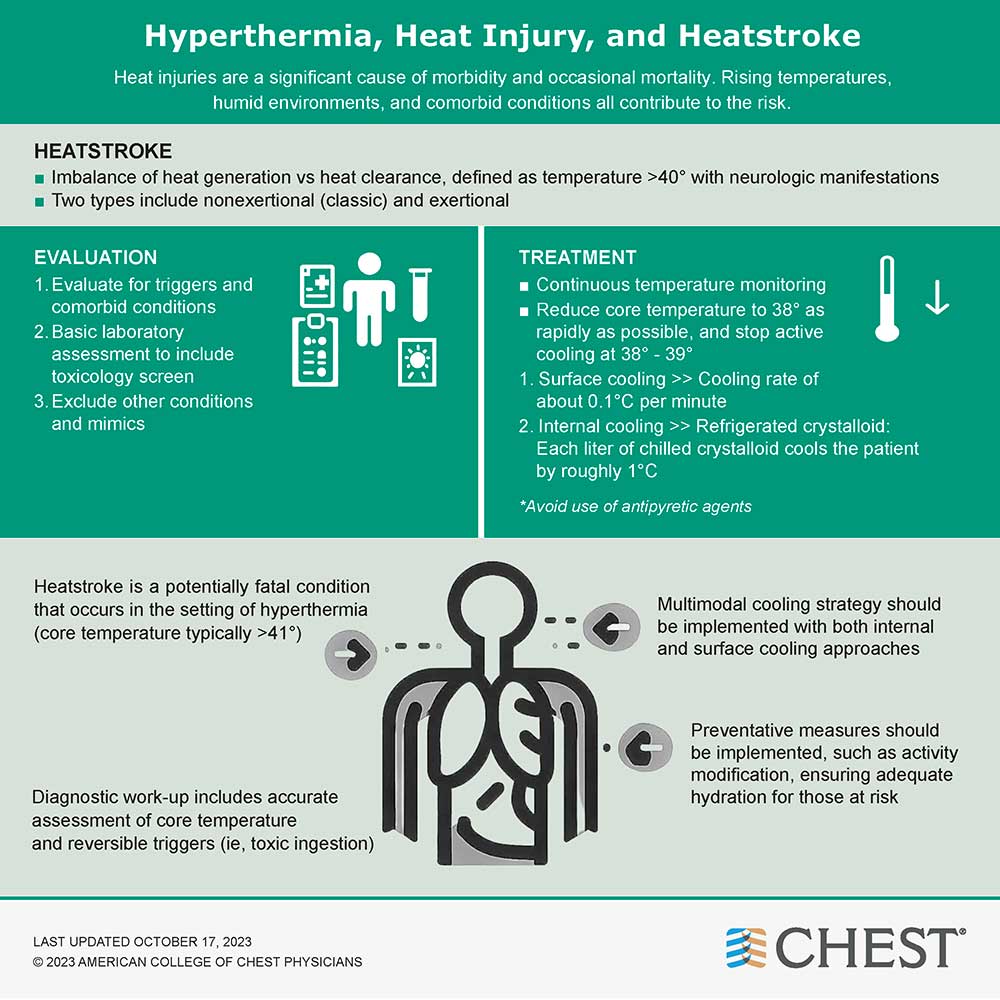 Heat stroke infographic