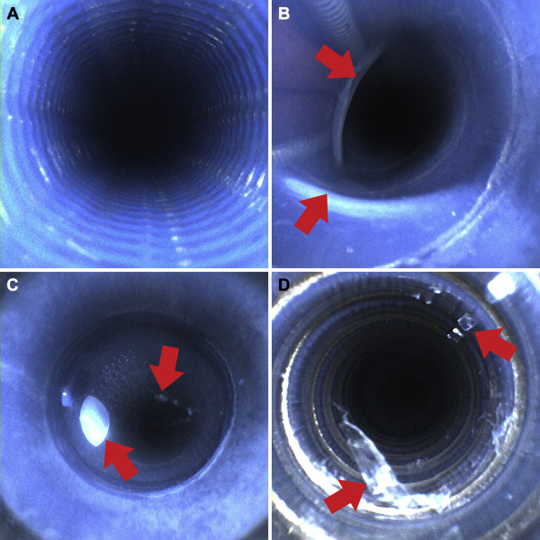 CHEST Fig 2